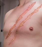 skaryfikacja tatuaż bliznowy